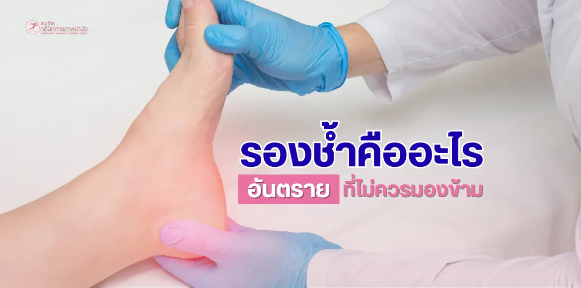 รองช้ำคืออะไร? อันตรายที่ไม่ควรมองข้าม และวิธีฟื้นฟูอย่างปลอดภัย